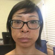amyasian